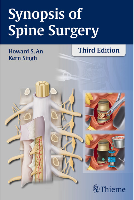 Synopsis of Spine Surgery