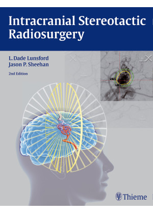 Intracranial Stereotactic Radiosurgery