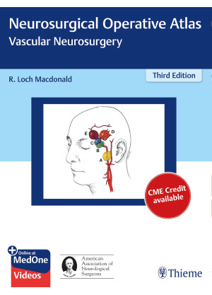 Neurosurgical Operative Atlas