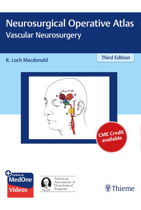 Neurosurgical Operative Atlas