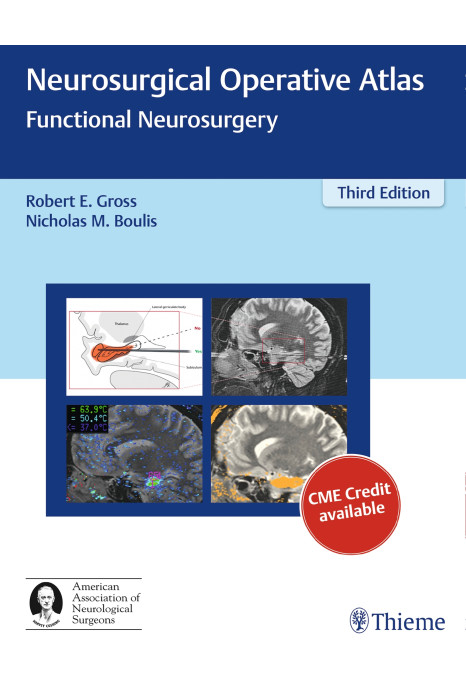 Neurosurgical Operative Atlas