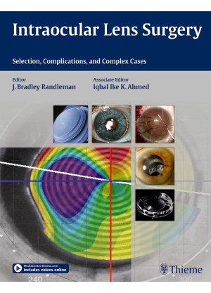 Intraocular Lens Surgery