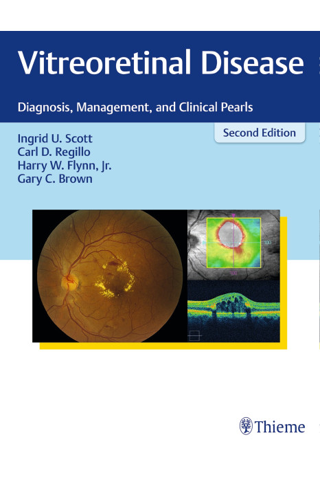 Vitreoretinal Disease