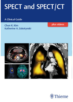 SPECT and SPECT/CT