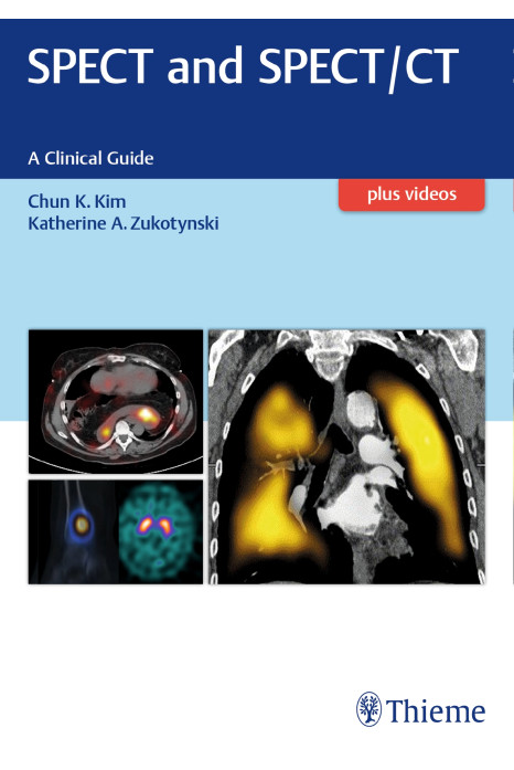SPECT and SPECT/CT
