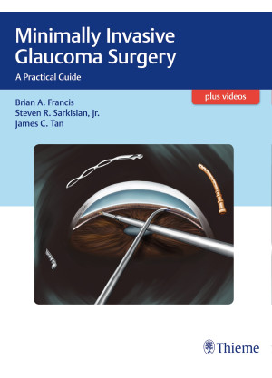 Minimally Invasive Glaucoma Surgery