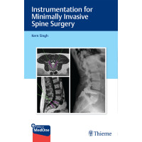 Instrumentation for Minimally Invasive Spine Surgery