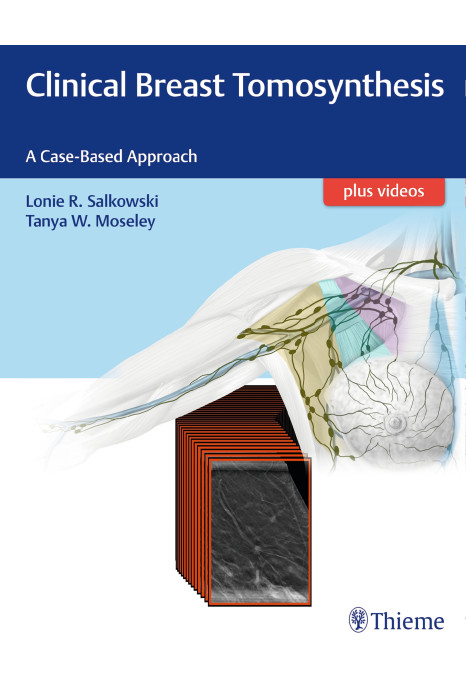 Clinical Breast Tomosynthesis