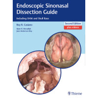 Endoscopic Sinonasal Dissection Guide