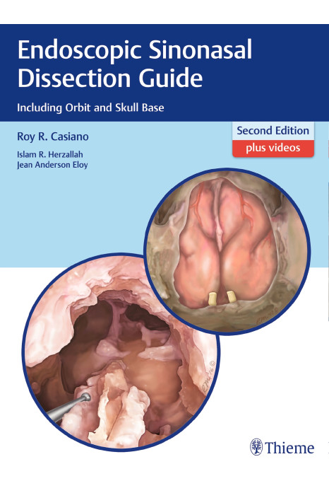 Endoscopic Sinonasal Dissection Guide