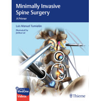 Minimally Invasive Spine Surgery