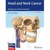 Head and Neck Cancer