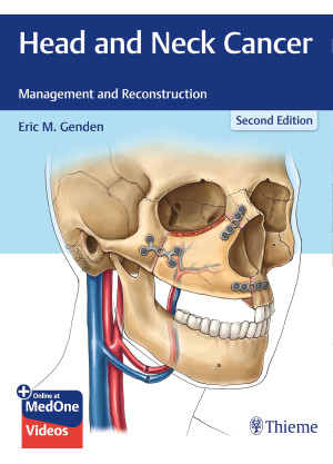 Head and Neck Cancer