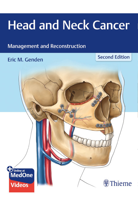 Head and Neck Cancer