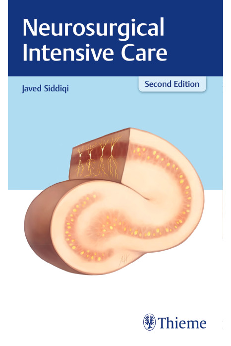 Neurosurgical Intensive Care