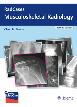 RadCases Q&A Musculoskeletal Radiology