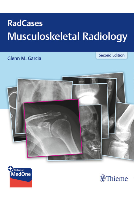 RadCases Q&A Musculoskeletal Radiology