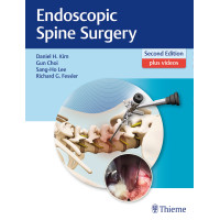 Endoscopic Spine Surgery