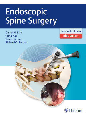 Endoscopic Spine Surgery