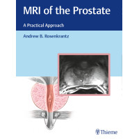 MRI of the Prostate