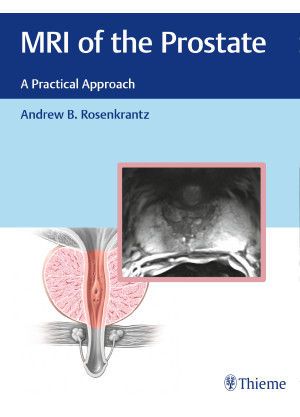 MRI of the Prostate