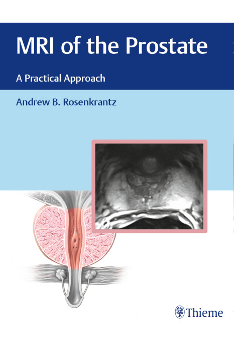 MRI of the Prostate