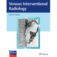 Venous Interventional Radiology