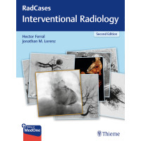 RadCases Q&A Interventional Radiology