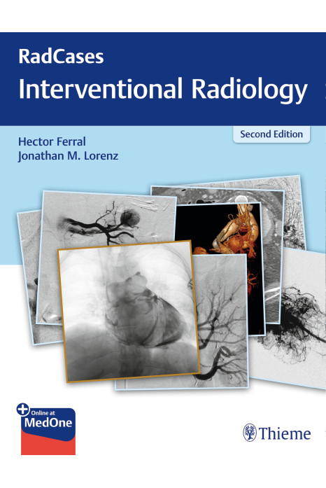 RadCases Q&A Interventional Radiology