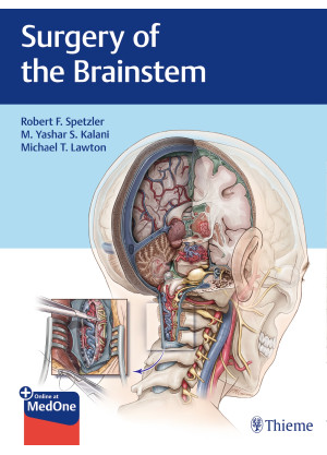 Surgery of the Brainstem