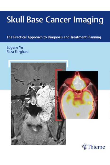 Skull Base Cancer Imaging