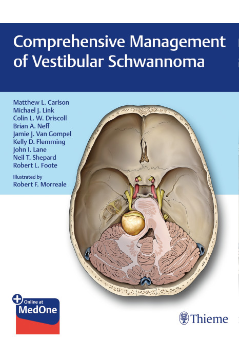 Comprehensive Management of Vestibular Schwannoma