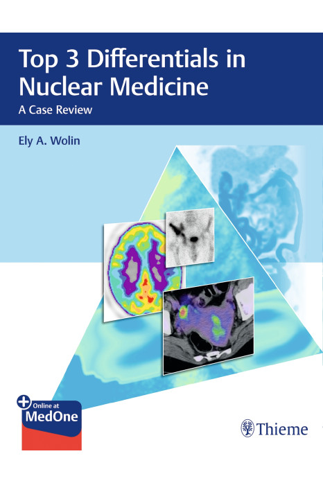 Top 3 Differentials in Nuclear Medicine