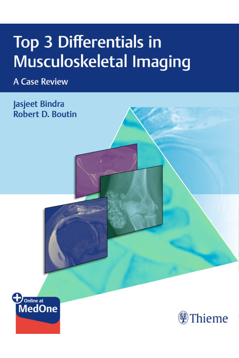 Top 3 Differentials in Musculoskeletal Imaging