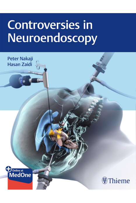 Controversies in Neuroendoscopy