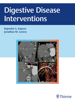 Digestive Disease Interventions