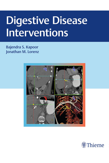 Digestive Disease Interventions