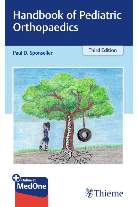 Handbook of Pediatric Orthopaedics