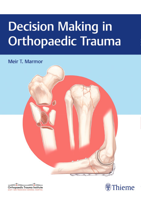 Decision Making in Orthopaedic Trauma