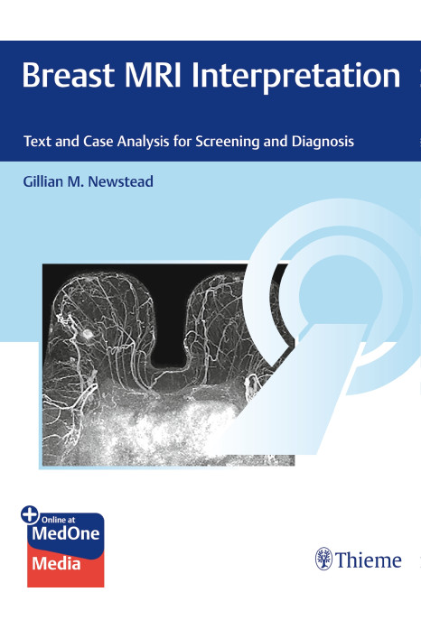Breast MRI Interpretation