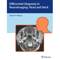 Differential Diagnosis in Neuroimaging: Head and Neck