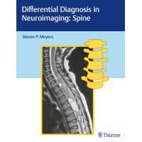 Differential Diagnosis in Neuroimaging: Spine