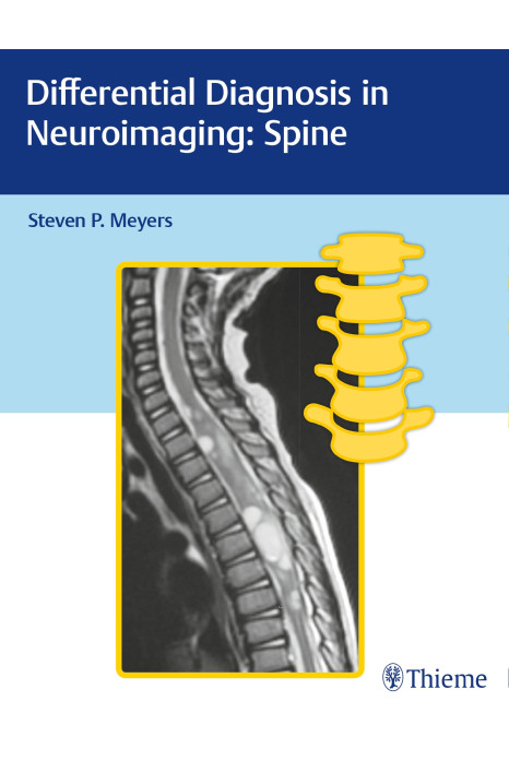 Differential Diagnosis in Neuroimaging: Spine