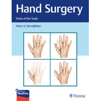 Hand Surgery