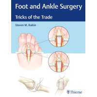 Foot and Ankle Surgery