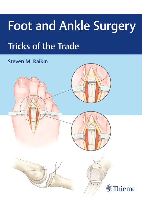 Foot and Ankle Surgery