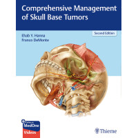 Comprehensive Management of Skull Base Tumors