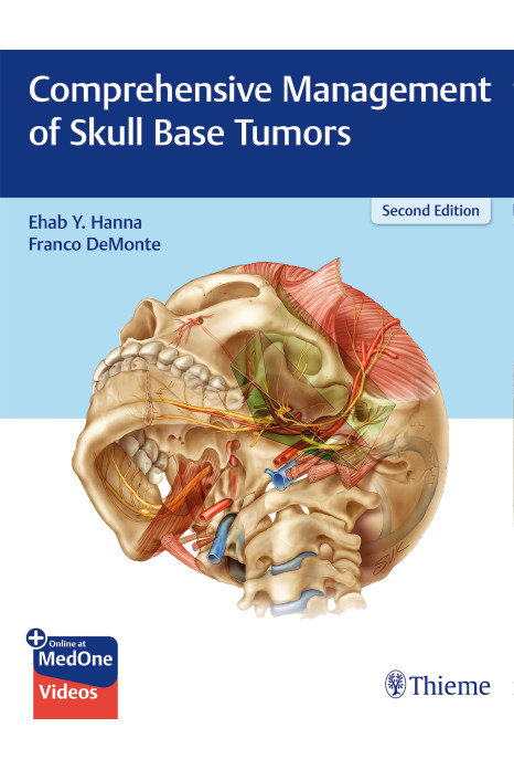 Comprehensive Management of Skull Base Tumors