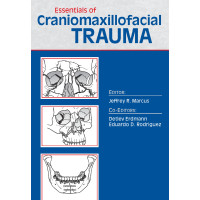 Essentials of Craniomaxillofacial Trauma