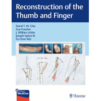 Reconstruction of the Thumb and Finger